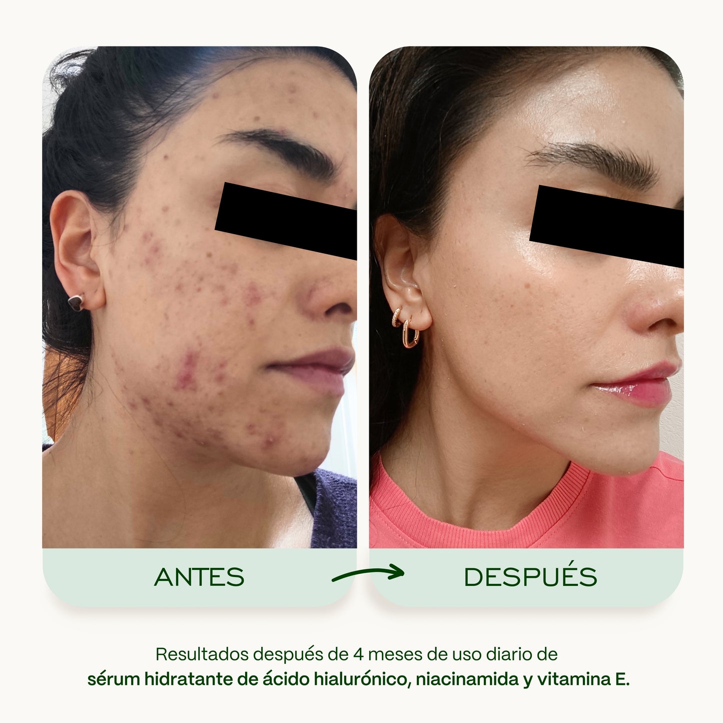 Sérum Hidratante con Ácido Hialurónico, Niacinamida y Vitamina E FPS 15 - 30 ml